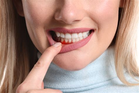 Itchy Gums: Understanding the Causes and Treatment Options – Fashion ...