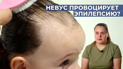МЕЛАНОФОРМНЫЙ НЕВУС | История Есении Стройкиной - YouTube
