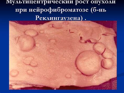Опухоли. Общие положения. Гисто- и морфогенез опухолей - презентация онлайн