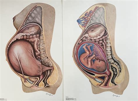Round Ligament Pain Early Pregnancy