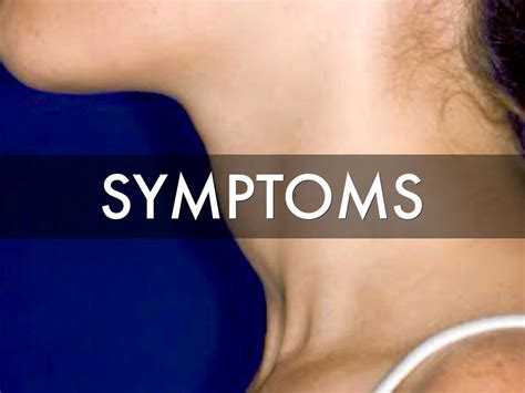 Thyroid Problem Symptoms: Thyroid Cancer Symptoms