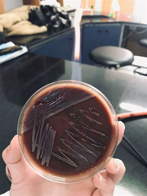 growth  bacteria  chocolate  chocolate  bacteria