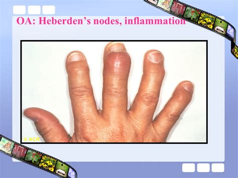 dranoori rheumatologist wwwarrhir