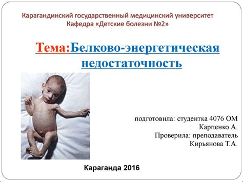 Белково-энергетическая недостаточность - презентация онлайн