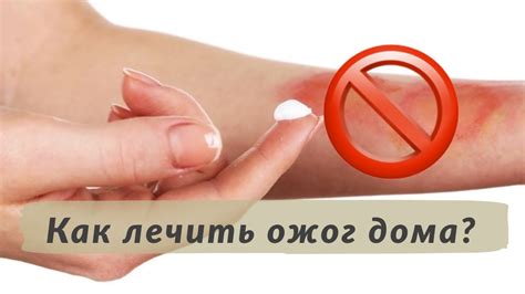 Как лечить ожог дома? Как убрать рубцы после ожогов? - YouTube