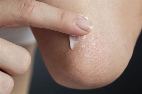 Como Clarear Os Cotovelos - Como fazer para clarear os cotovelos? Veja dicas e melhore a aparência