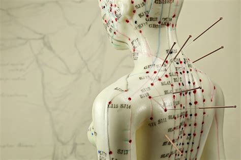 Introduction to Korean Medicine Health Insurance - Korean Medicine World