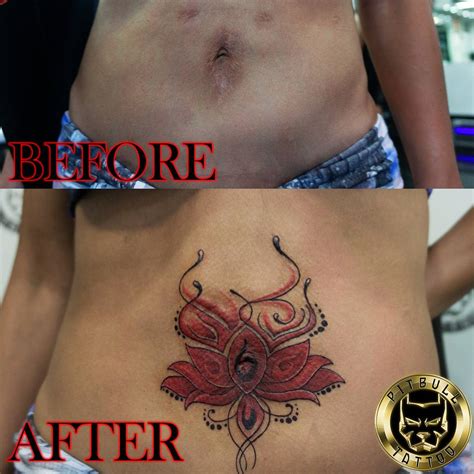 Over Scars Tattoo Specializations