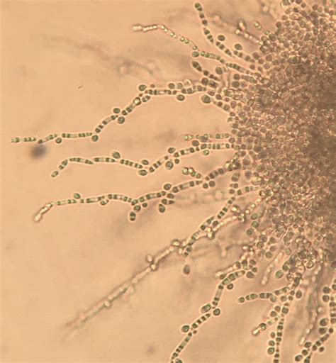 Candida parapsilosis