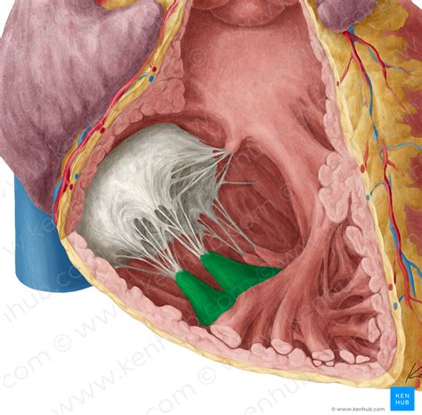 Anterior papillary muscle of right ventricle (#5709) – Kenhub Image ...