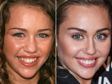 Miley Cyrus Before and After - The Skincare Edit