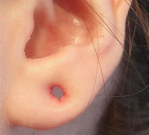 how to fix stretched ear piercing