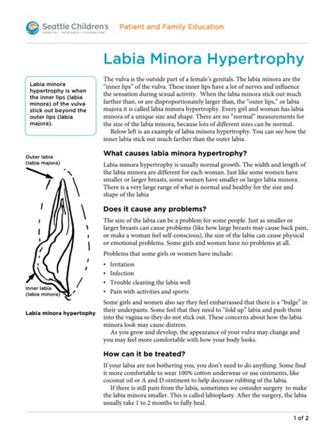 Labia Minora Hypertrophy: Patient Education & Treatment