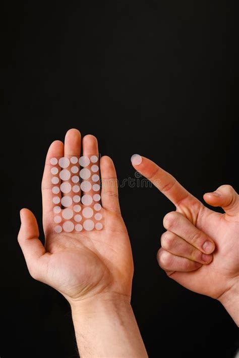 Acne Patches To Get Rid of Problematic Zits on Irritated Skin without ...