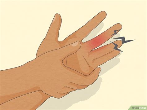 How to Determine if a Finger Is Broken: Symptoms & More