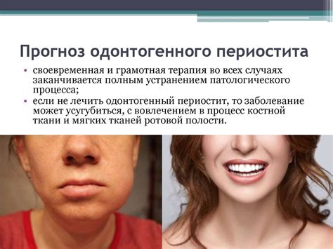 Одонтогенные воспалительные заболевания челюстно-лицевой области ...