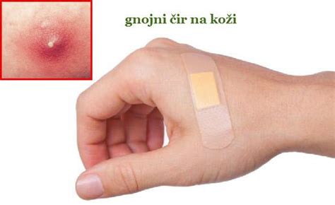 Pin on Prirodno Lečenje Biljem - Lekovi Iz Prirode