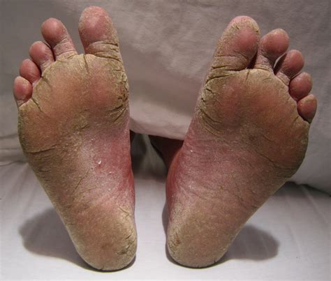 Call today for your appointment - River Podiatry I The Best Foot and