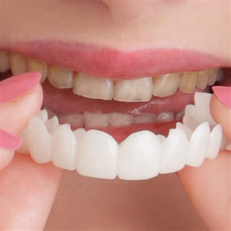 brigtviee clip  veneers  pairs clip  veneers teeth instant
