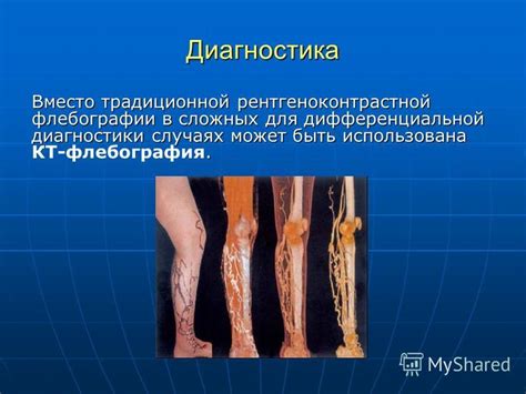 Презентация на тему: "Илеофеморальный флеботромбоз ". Скачать бесплатно ...