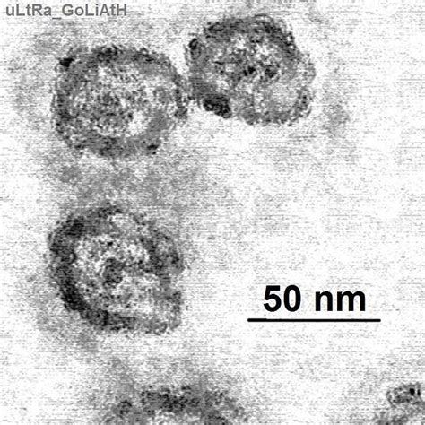 Animal model of hepatitis C created | Science News | Naked Scientists