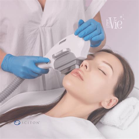 Forever Clear BBL Acne Treatment - La Vie Med Spa