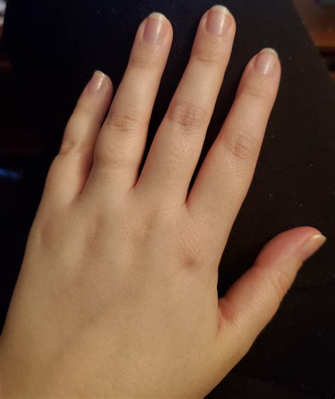 Supplements are working! Haven't been able to grow my nails this long in years! : r/Hypothyroidism