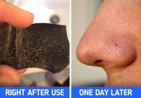 Unbelievable Blackhead Removal 2024: The Truth About Pore Strips - 7uv49m1