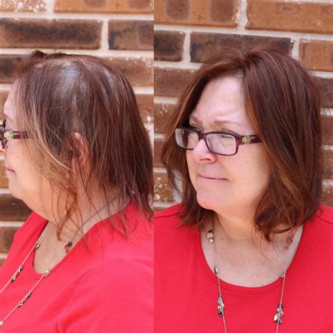 thinning hair solutions - Garnish Hair Studio | Thin hair solutions
