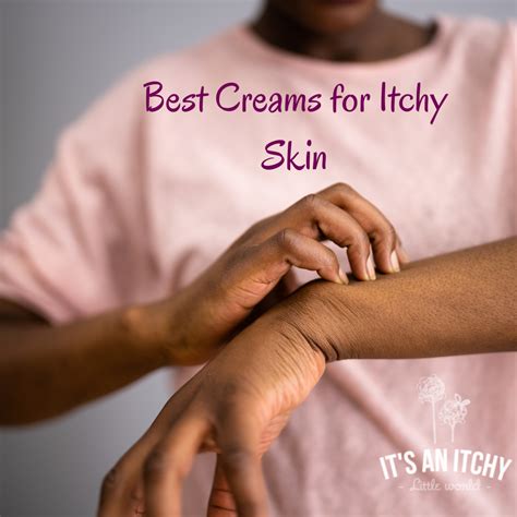 creams  itchy skin