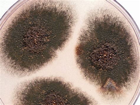 Aspergillus | Mycology | University of Adelaide