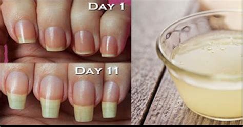 How long does it take for nails to grow - perracing