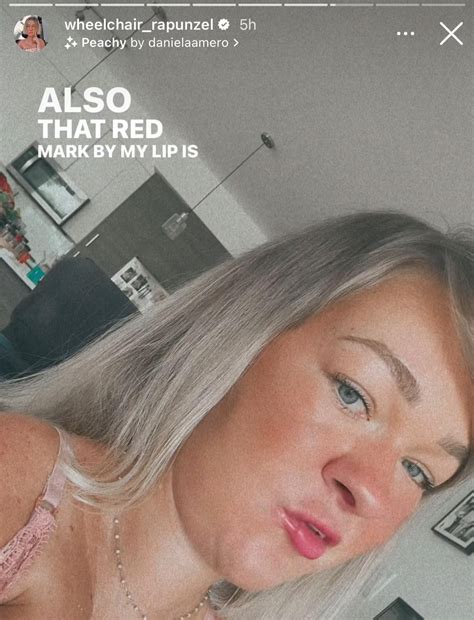 Wait. What. : r/wheelchair_rapunzel_