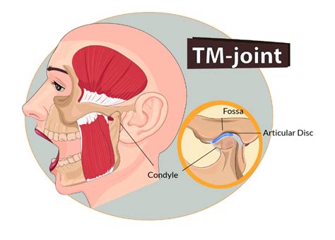 Why TMJ Noise Is Important | Cosmetic Dentistry | Dr. Henry