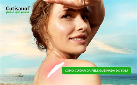 Como Clarear A Pele Queimada Do Sol