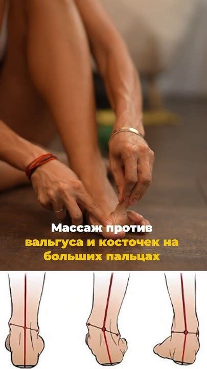 Массаж против ВАЛЬГУСА и КОСТОЧЕК НА БОЛЬШИХ ПАЛЬЦАХ #shorts #стопы # ...