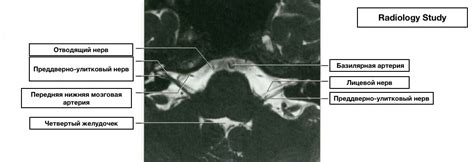 Черепные нервы. МРТ анатомия — 24Radiology.ru