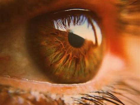 Graves’ eye disease: symptoms, causes and treatment - Nexus Newsfeed