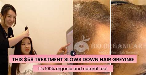 This Popular Organic Treatment Reverses Grey Hair Without Dyes - Here's ...