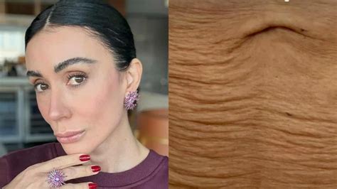 Michelle Barros Antes E Depois Cirurgia - Michelle Barros choca com antes e depois de sua barriga após tratamento ...