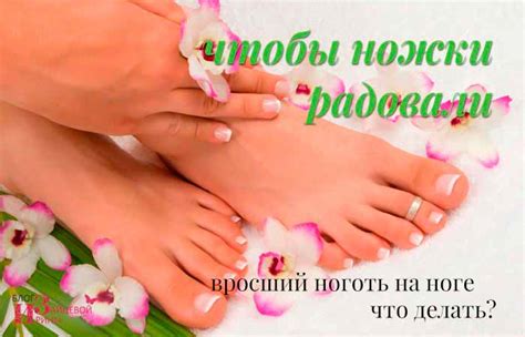 Вросший ноготь на ноге. Что делать и как лечить. Лечение и удаление ...