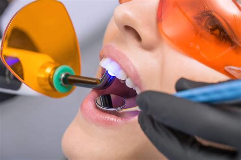 How Much Do Lumineers Cost | East Valley Dental Professionals