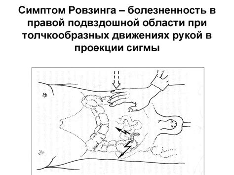 Острый аппендицит - презентация онлайн