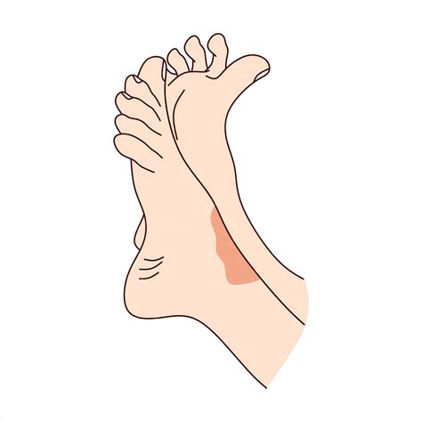 Premium Vector | Feet with skin rash psoriasis
