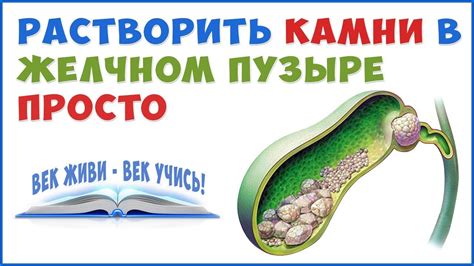 Как растворить Камни в Желчном Пузыре и Печени без операции! - YouTube