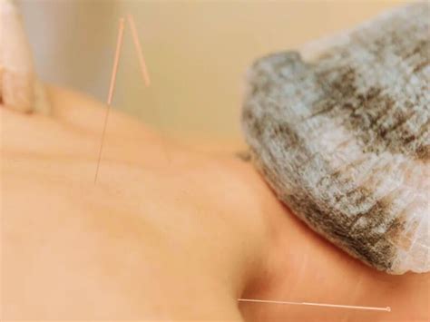 O Que Significa Sonhar Com Agulha Espetada No Corpo