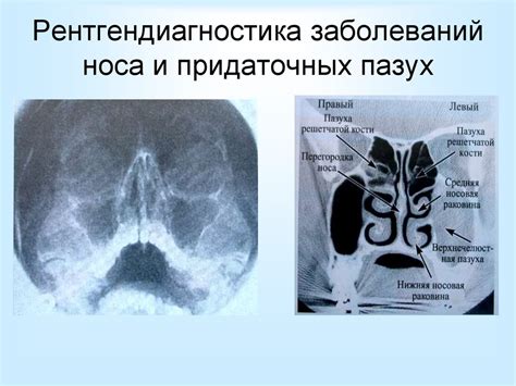 Анатомия и физиология носа - презентация онлайн