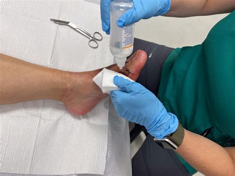 wound cleaning  san antonio tx