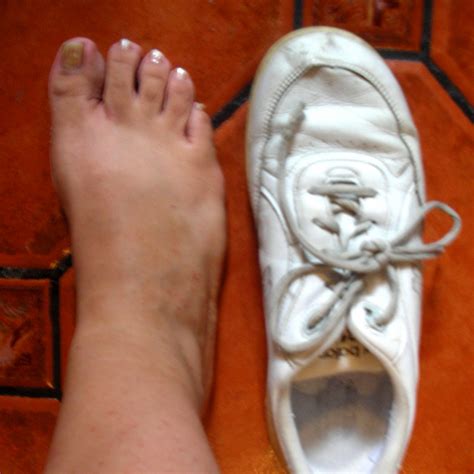 Barefoot Fresca: Barefoot in the Park - Afterlogue -- or How Foot Shape ...
