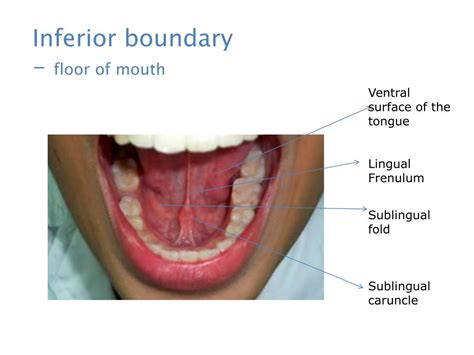 Floor Of Mouth Anatomy Ppt | Review Home Decor